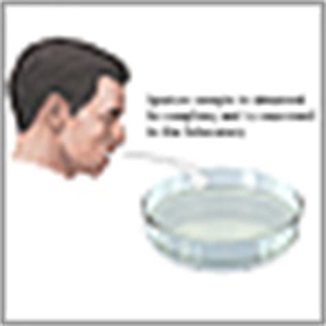 Sputum culture: MedlinePlus Medical Encyclopedia.